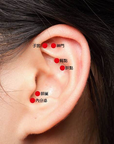 多囊性卵巢症候群的穴道按摩與針灸療法