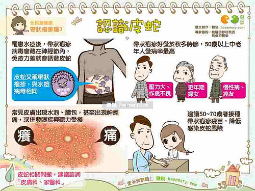 帶狀皰疹