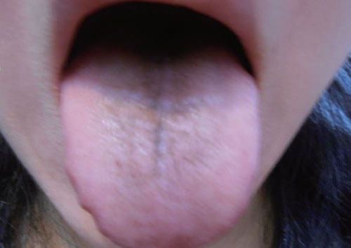圖說：舌苔與脈象