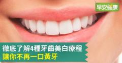 4種牙齒美白療程，讓你不再一口黃牙