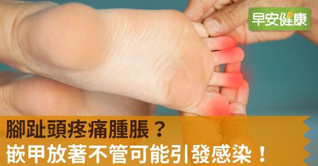 腳趾頭疼痛腫脹？嵌甲放著不管可能引發感染！