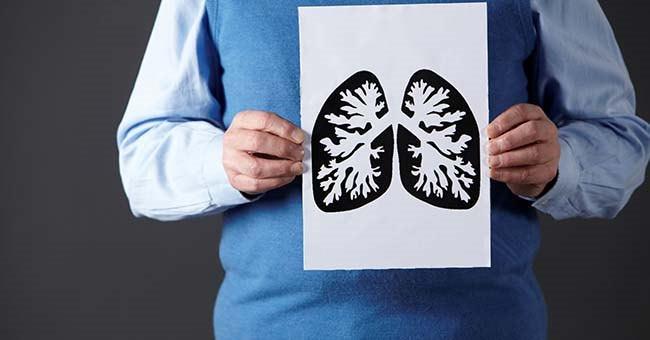 科學家發現愛滋病毒破壞肺部組織的可能機制
