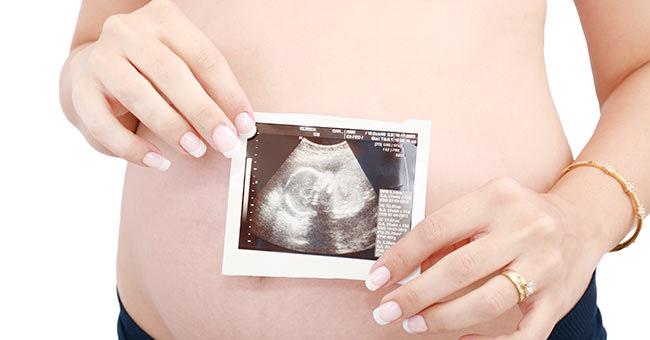 子宮中的胎兒可能即有辨識臉部特徵的能力