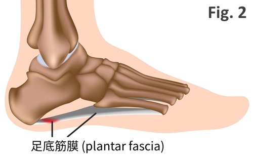 足底筋膜是什麼 足底筋膜位置