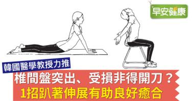 椎間盤突出、受損非得開刀？1招趴著伸展有助良好癒合