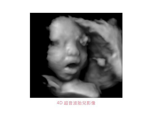 超音波胎兒影像