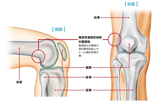 膝蓋,疼痛,髂脛束摩擦症候群