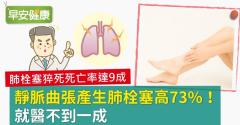 靜脈曲張產生肺栓塞高73％！就醫不到一成
