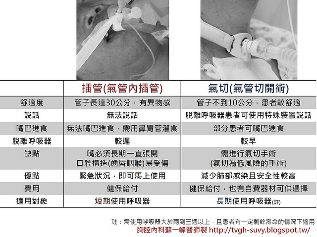 氣切與插管的比較圖表，圖片由蘇一峰醫師授權提供