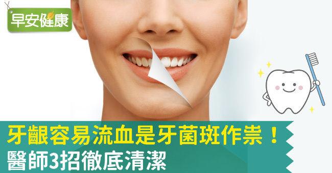 牙齦流血原因是牙菌斑作祟！醫師：解決口臭就要用對牙膏