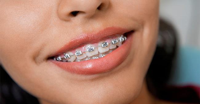 矯正牙齒咬合就能增進平衡感，預防運動傷害！
