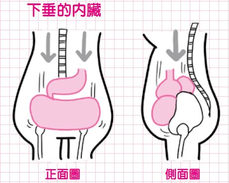 內臟下垂,小腹,減肥
