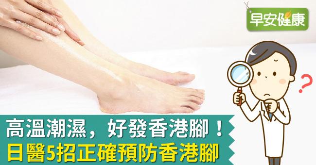 高溫潮濕，好發香港腳！日醫5招正確預防香港腳