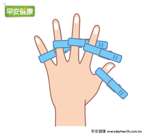 曬衣夾按摩穴道改善糖尿病
