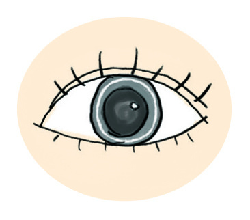血脂異常症狀：黑眼球周圍出現白色圓圈