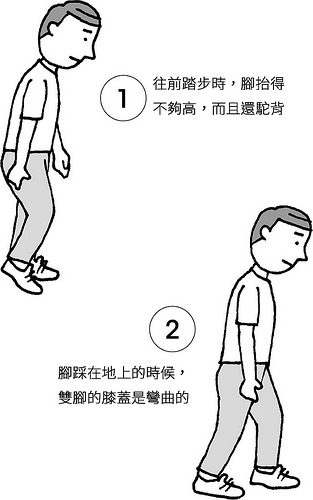 膝蓋步行法