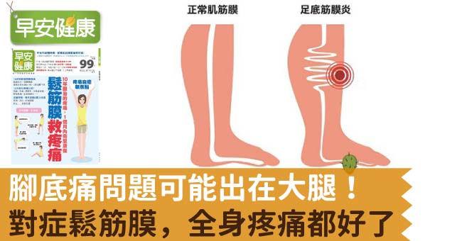 腳底痛問題可能出在大腿！對症鬆筋膜，全身疼痛都好了