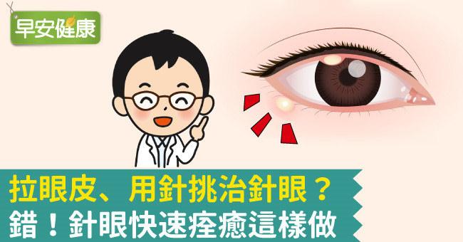 針眼多久會自己好？會傳染嗎？從原因、症狀到塗藥膏的針眼大全