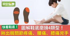 圖解鞋底磨損4類型！揪出髖關節疼痛、腰痛、膝痛兇手