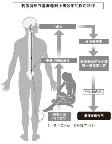 刺激腿部的足三里穴，能夠活化催產素的生成，並促進腦內啡分泌，發揮止痛作用。