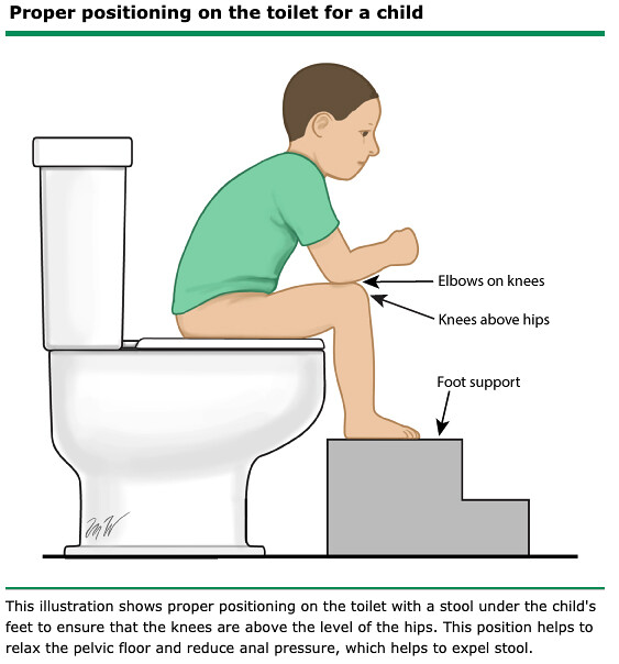 如廁時可在腳下墊個小凳子，可助排便