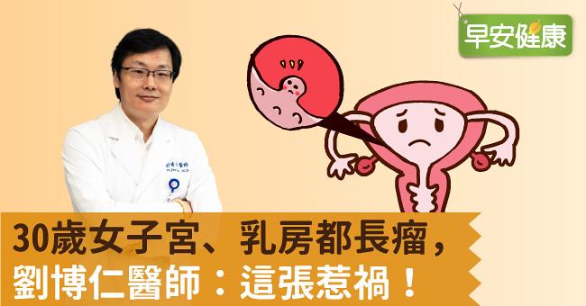 30歲女子宮、乳房都長瘤,劉博仁醫師:這張惹禍!