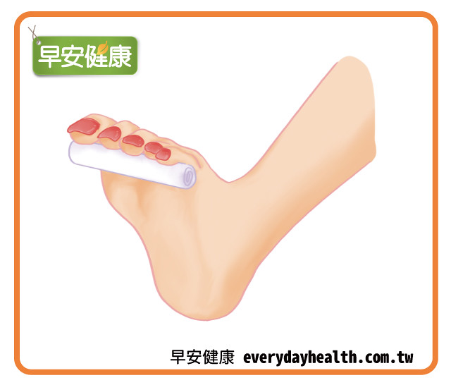 腳底塞衛生紙捲改善腳趾翹起、指甲變小