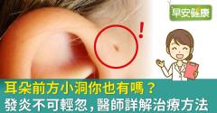 耳前廔管發炎一定要開刀嗎？日常照護不可忽略