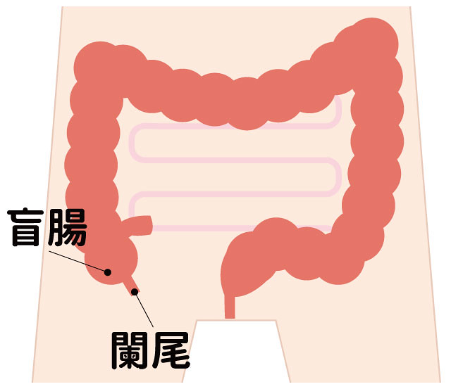 盲腸位置、闌尾位置