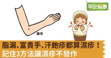 脂漏、富貴手、汗皰疹都算濕疹！記住3方法讓濕疹不發作