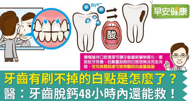 牙齒有刷不掉的白點是怎麼了？醫：牙齒脫鈣48小時內還能救！