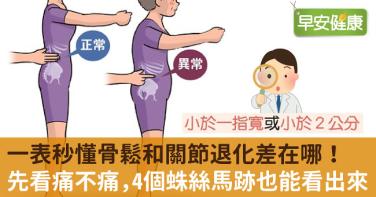 一表秒懂骨鬆和關節退化差在哪！先看痛不痛，4個蛛絲馬跡也能看出來