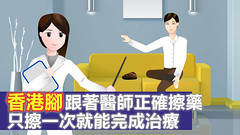 香港腳跟著醫生正確擦藥，只擦一次就能完成治療