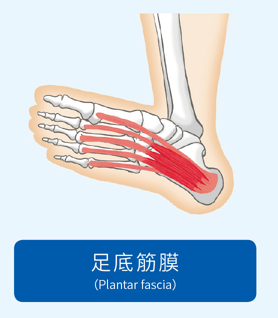足底筋膜示意圖