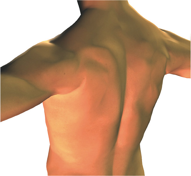 頸部後方、肩膀和背部等的痠痛和疼痛，是顳顎關節症候群中經常出現的症狀。
