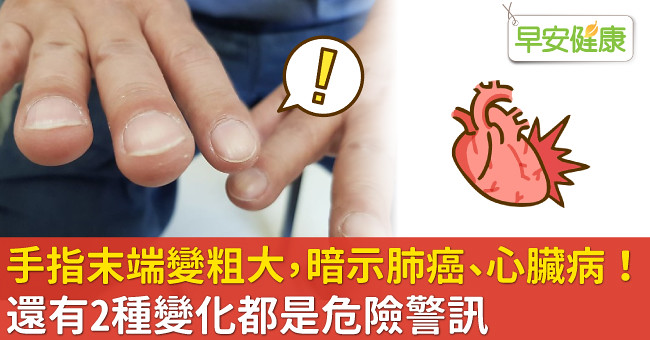 手指末端變粗大，暗示肺癌、心臟病！還有2種變化都是危險警訊