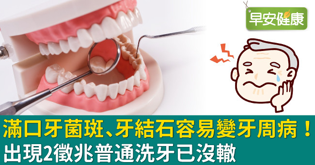 滿口牙菌斑、牙結石容易變牙周病！出現2徵兆普通洗牙已沒轍