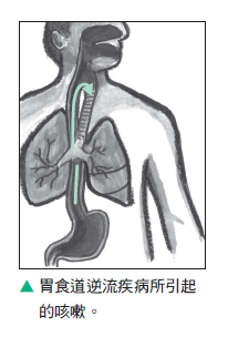 胃食道逆流