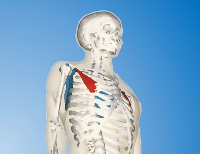 肩膀疼痛的第二條關鍵肌肉：胸小肌。