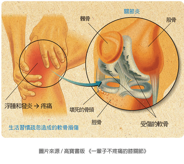 膝蓋