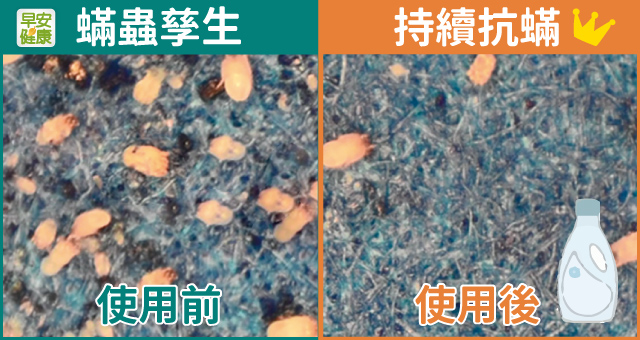 ARIEL使用前後
