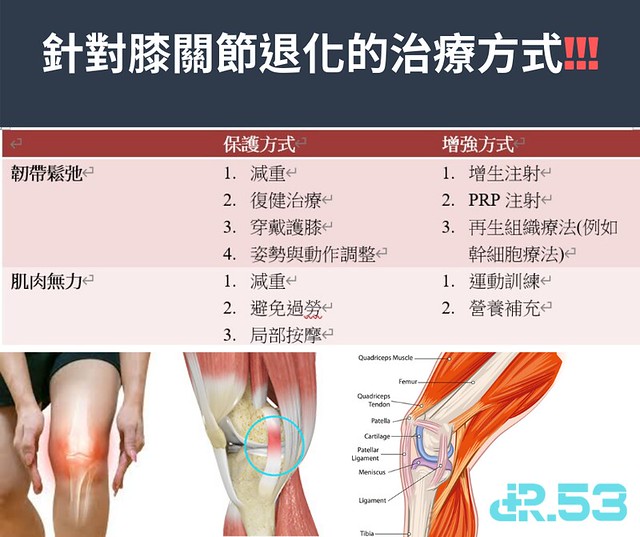 針對膝關節退化的治療方式