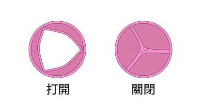 正常主動脈瓣膜