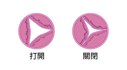 主動脈瓣膜狹窄