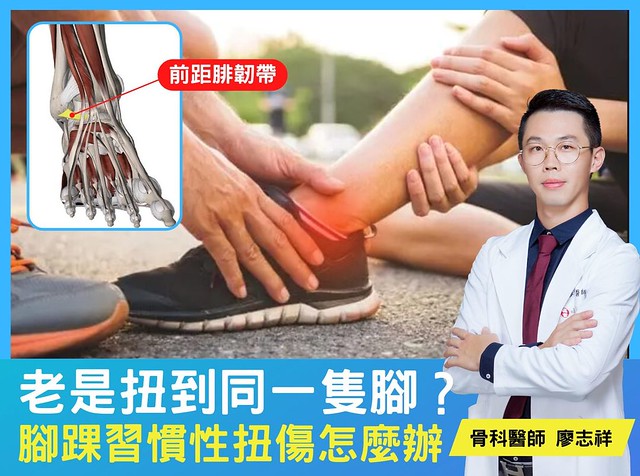 老是扭到同一隻腳?腳踝習慣性扭傷怎麼辦