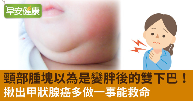 頸部腫塊以為是變胖後的雙下巴！揪出甲狀腺癌多做一事能救命
