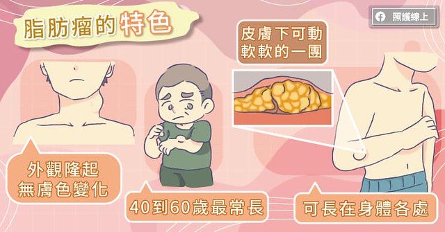 脂肪瘤的特色