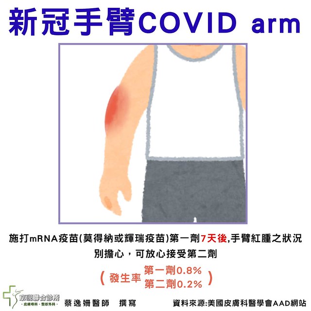 施打mRNA疫苗（莫得納或輝瑞疫苗）第一劑7天後，手臂紅腫別擔心，可放心接受第二劑。