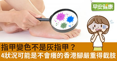 指甲變色不是灰指甲？4狀況可能是不會癢的香港腳嚴重得截肢