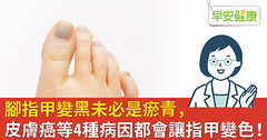 腳指甲變黑未必是瘀青，皮膚癌等4種病因都會讓指甲變色！